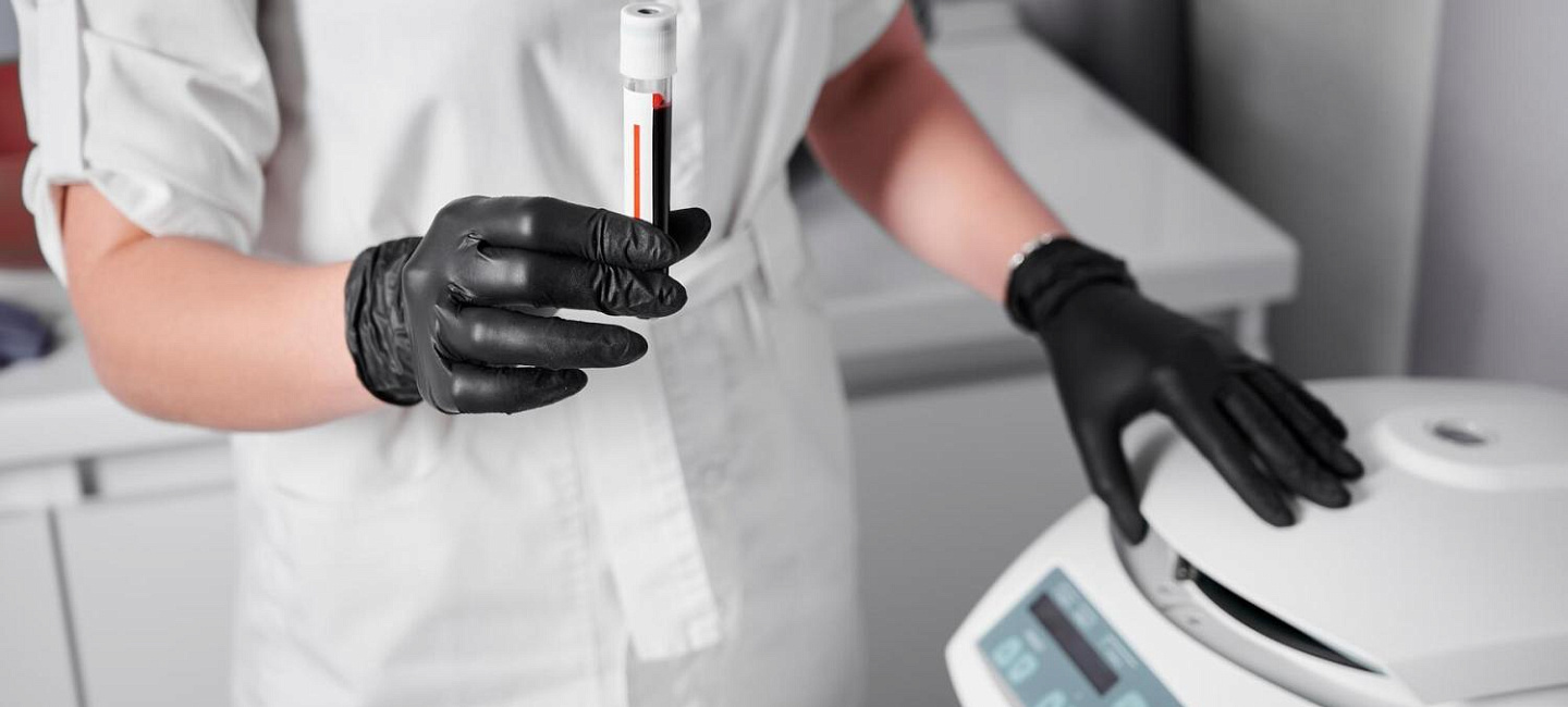 Холестерин: нормальный, низкий и высокий — нормы для взрослых и детей