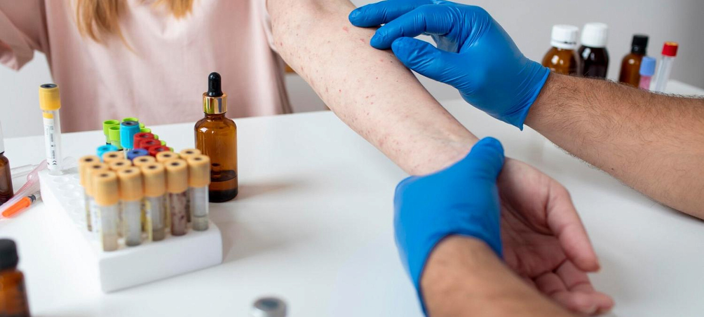 Чем занимается аллерголог?