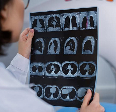 Как подготовиться к КТ легких?